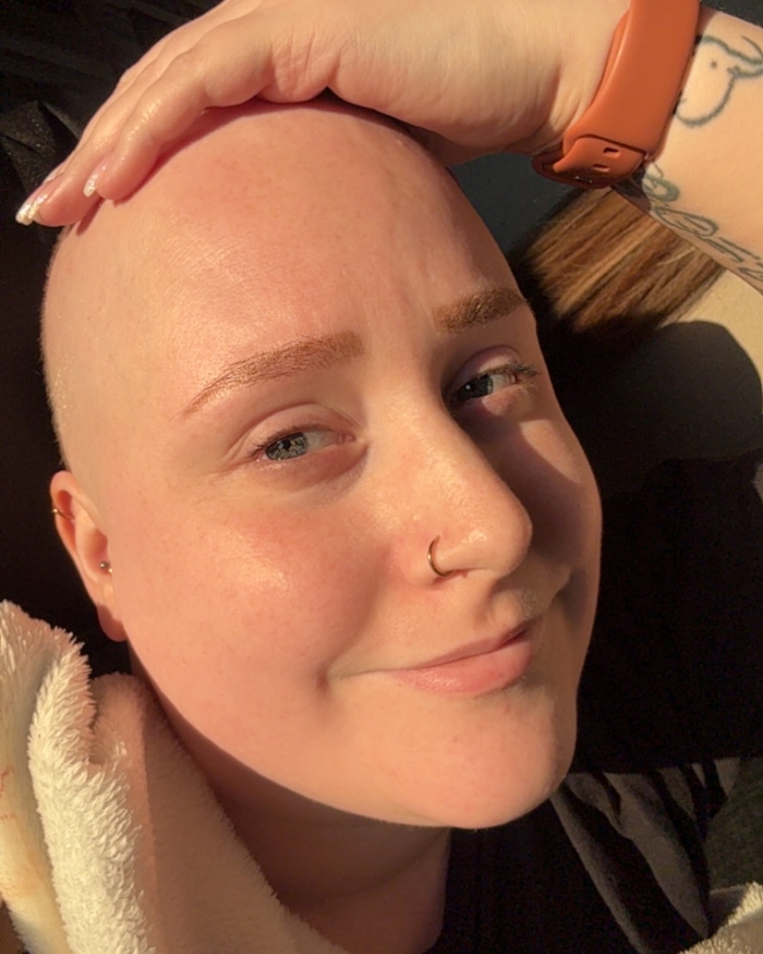 Jennifer lächelt und streicht sich über die Glatze