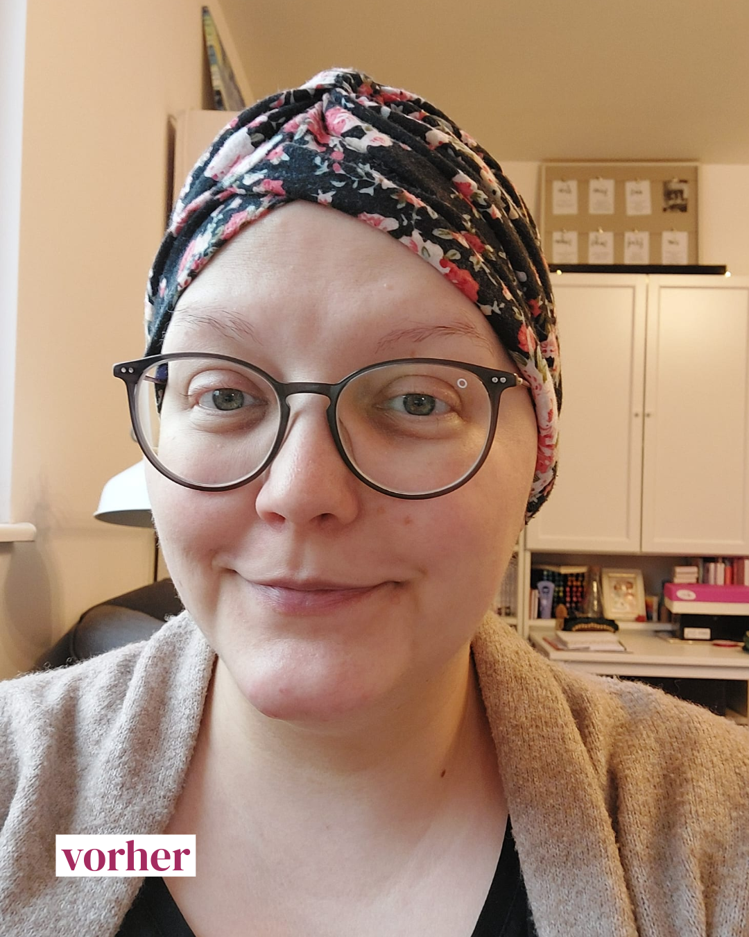 Look Good Feel Better Teilnehmerin Susann ungeschminkt vor dem Kosmetikseminar