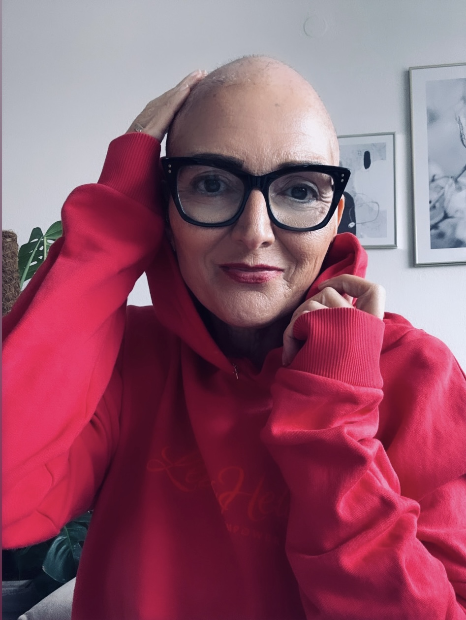 Claudie streicht sich über ihre Glatze